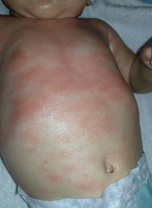 85f1d1a29ee27969med.jpg
