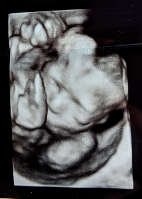 8ee42b3741d03034med.jpg