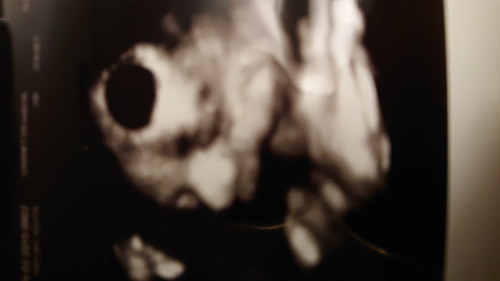 a68f23bf92347004med.jpg